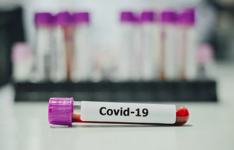 covidtesting-5