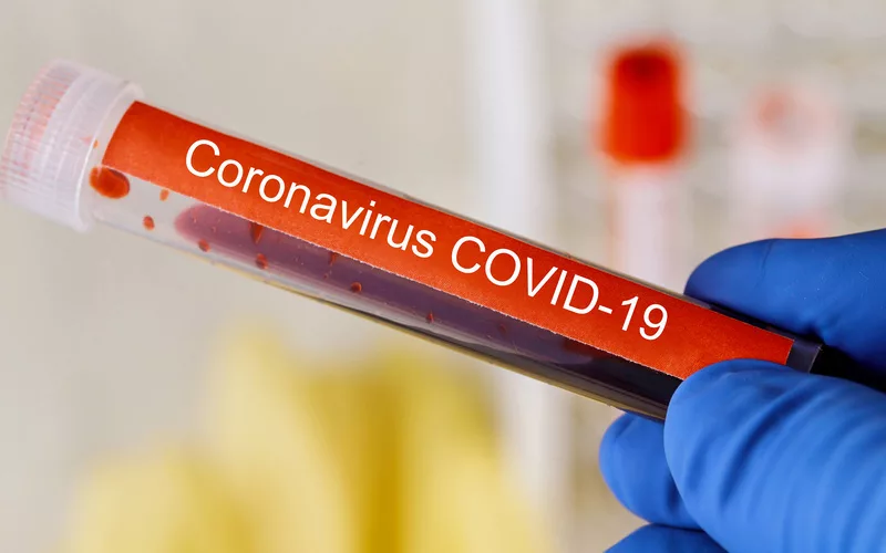coronaviruscovid-9