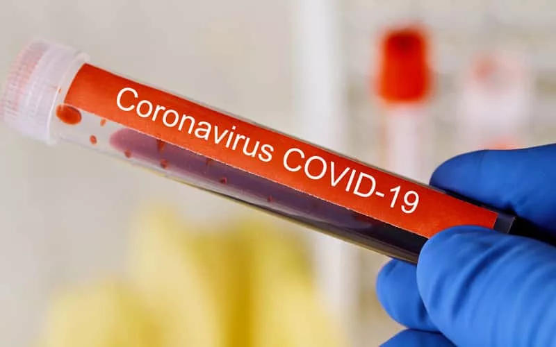 coronaviruscovid