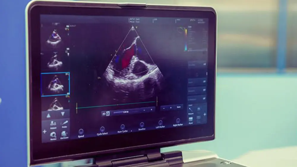 LMC heart sonograpy