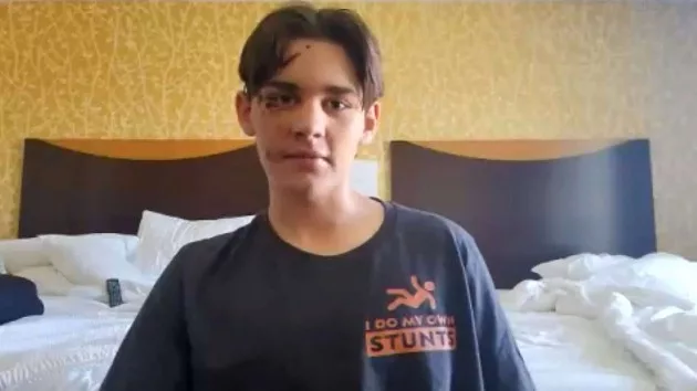 teen-fall-abc-ps-230814_1692020998535_hpmain166619