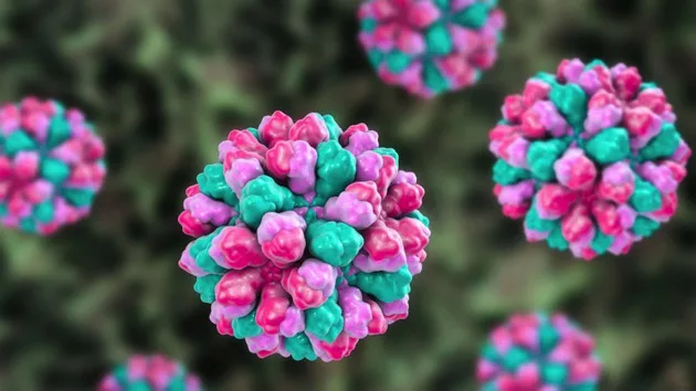 norovirus-rf-gty-ml-230530_1685452395280_hpmain_16x9_992640109