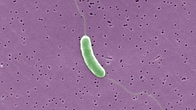 gettyimages_bacteria_090523923005