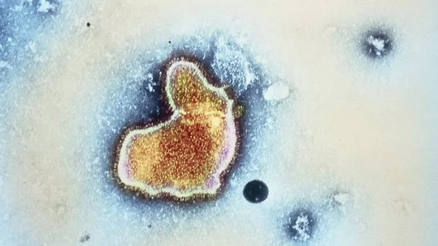 gettyimages_rsv_090723272504