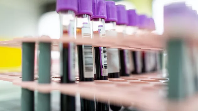 gettyrf_9522_bloodsamplelab2028129778392