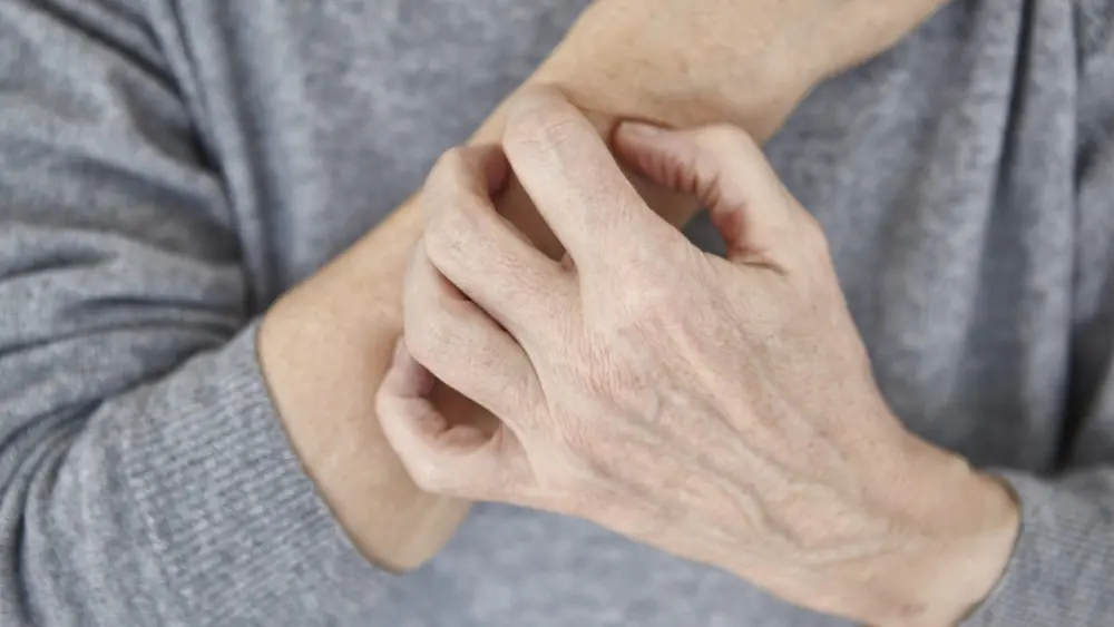 senior-woman-scratching-arm-close-up