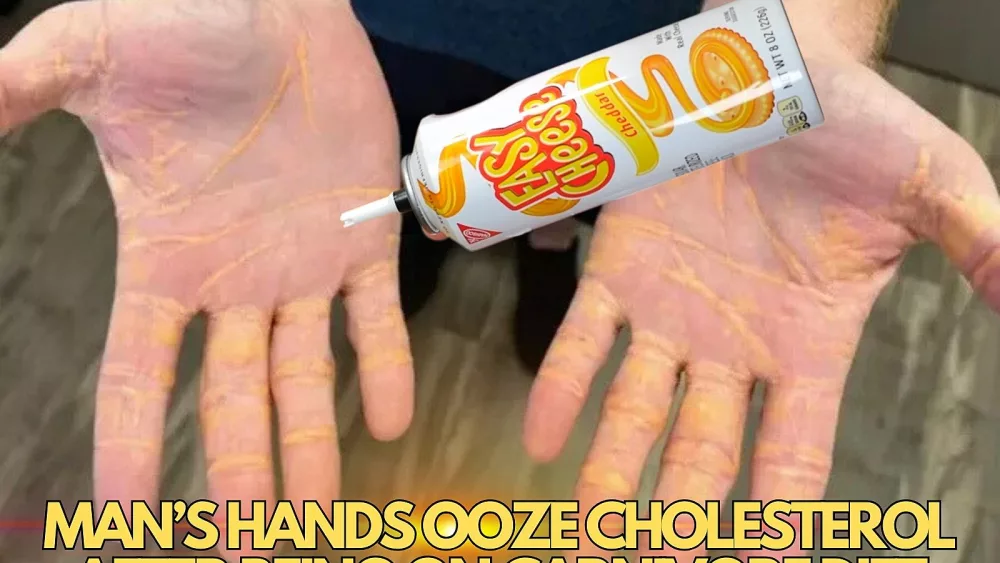 attachment-man25e225802599s-hands-ooze-cholesterol-after-being-on-carnivore-diet-1