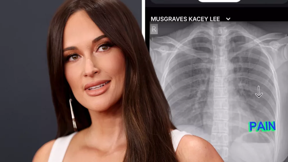 attachment-musgraves-broken-rib