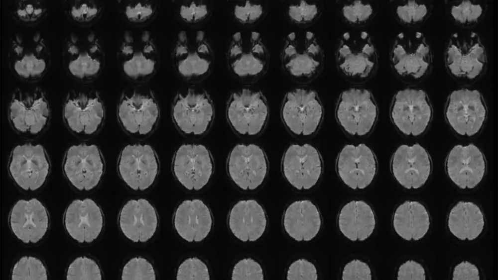 brain-jpg-691aa81a16706289107