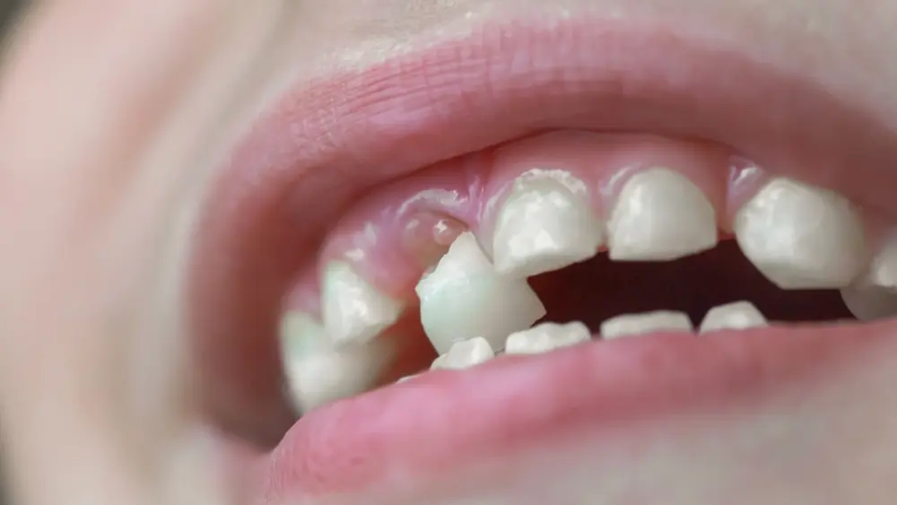 attachment-untitled-design-2025-12-08t074218-810