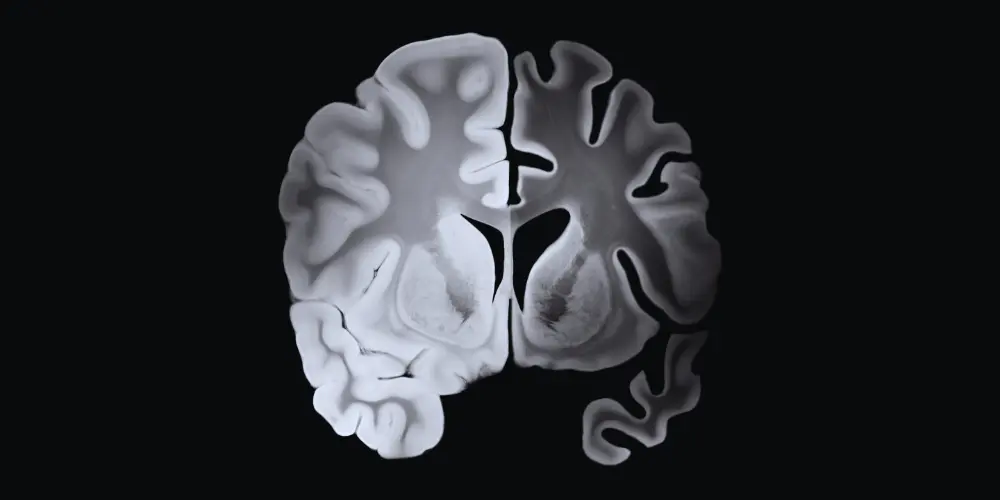 brazos-news-image-alzheimers-brain-scan