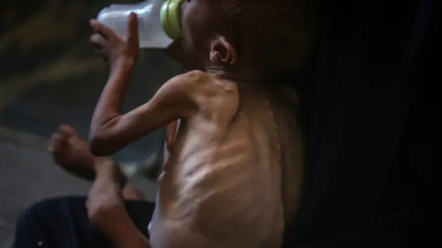 getty20gaza20hunger560802