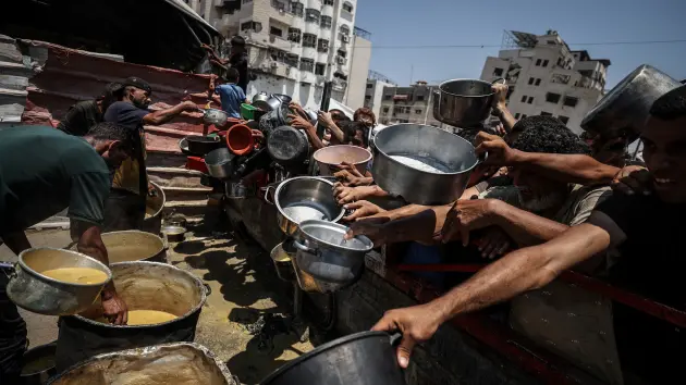 getty_starving_729986332