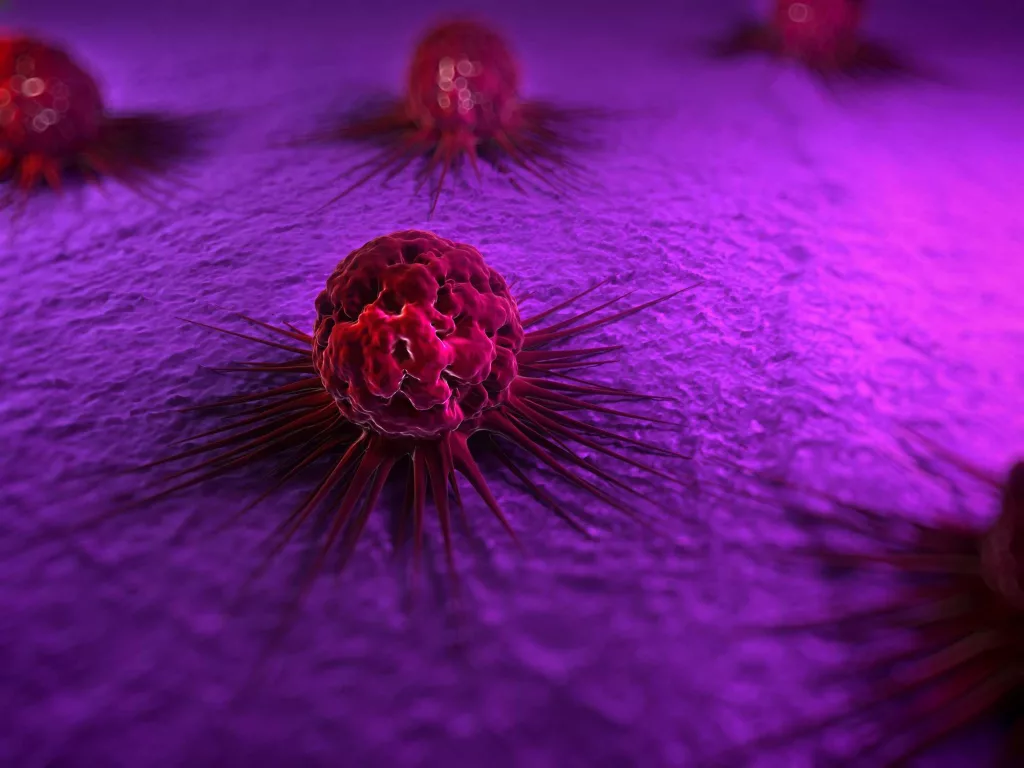 Have you heard of 'Stage 0' breast cancer? A doctor explains