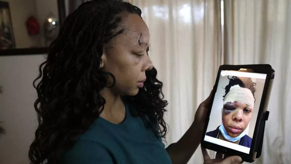 George Floyd protester injured by rubber bullet receives $2M settlement