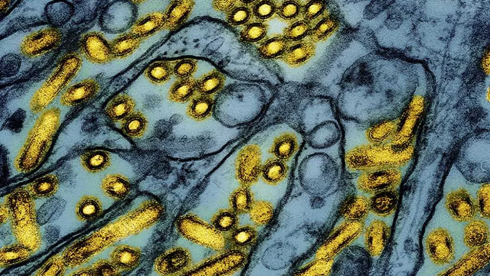 Gov. Newsom declares state of emergency for bird flu in California