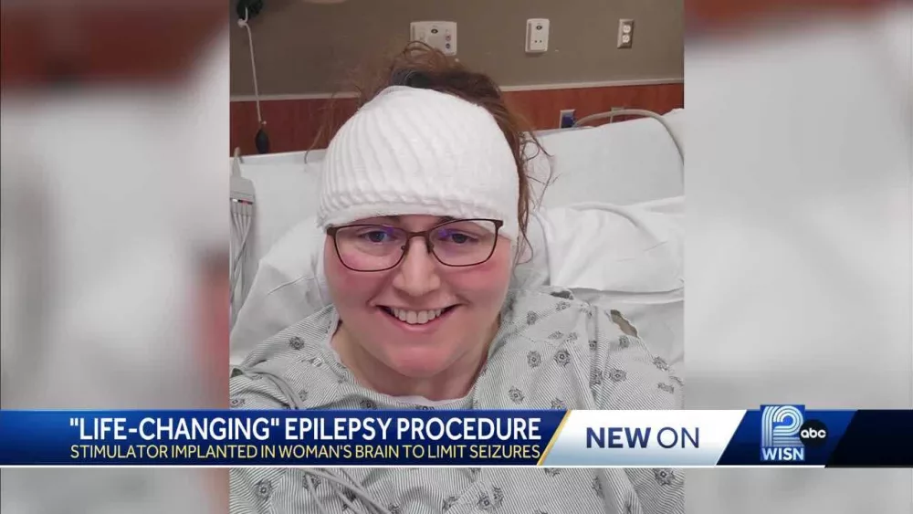 Woman undergoes 'life-changing' procedure years after epilepsy diagnosis