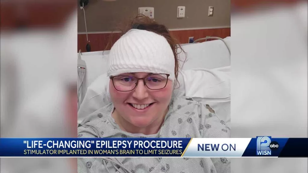 Woman undergoes 'life-changing' procedure years after epilepsy diagnosis