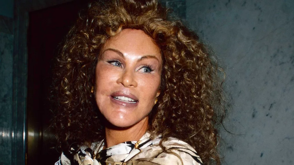 Jocelyn Wildenstein, 'Catwoman' socialite known for her extreme cosmetic surgery, dies