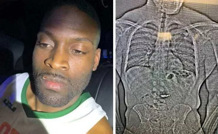 Man swallows nearly $1M in stolen Tiffany jewelry before arrest, police say