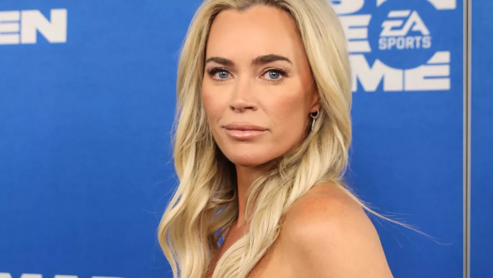 Teddi Mellencamp says her melanoma is now stage 4