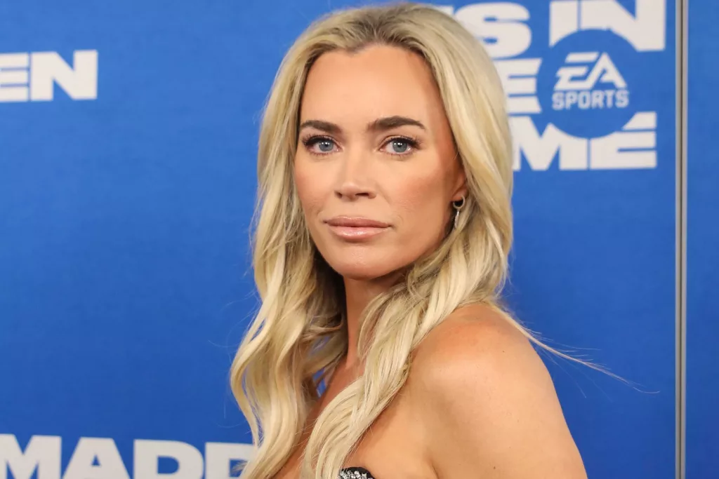Teddi Mellencamp says her melanoma is now stage 4
