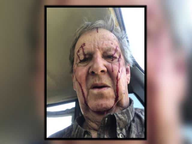'He thought I was a turkey': Man attacked by bobcat while hunting