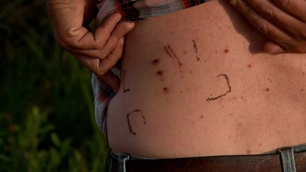 'It was me or him:' Man fights off bobcat with rabies in brutal attack