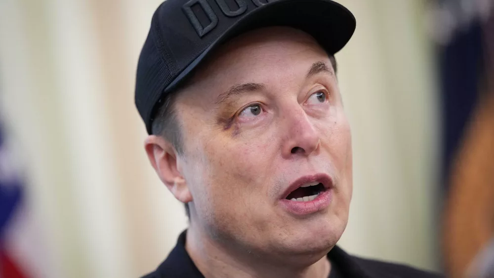 Elon Musk appeared at exit press conference with black eye. Here's what he said happened