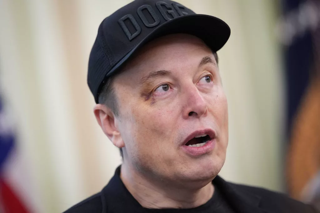 Elon Musk appeared at exit press conference with black eye. Here's what he said happened