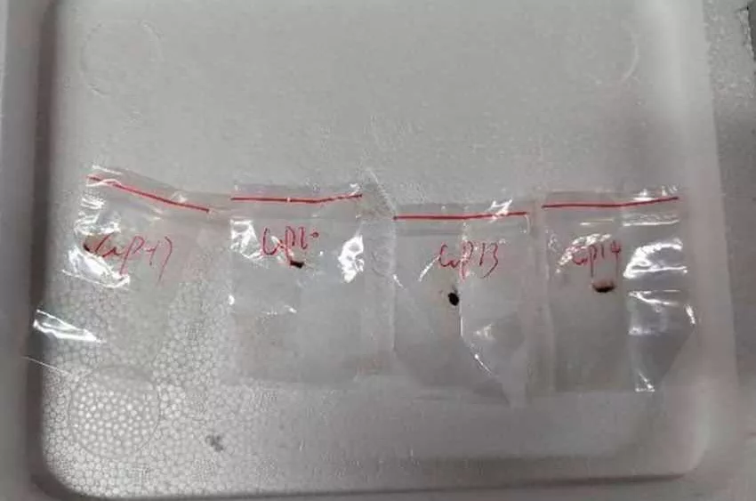 Chinese researchers charged with smuggling biological pathogen to study at US lab