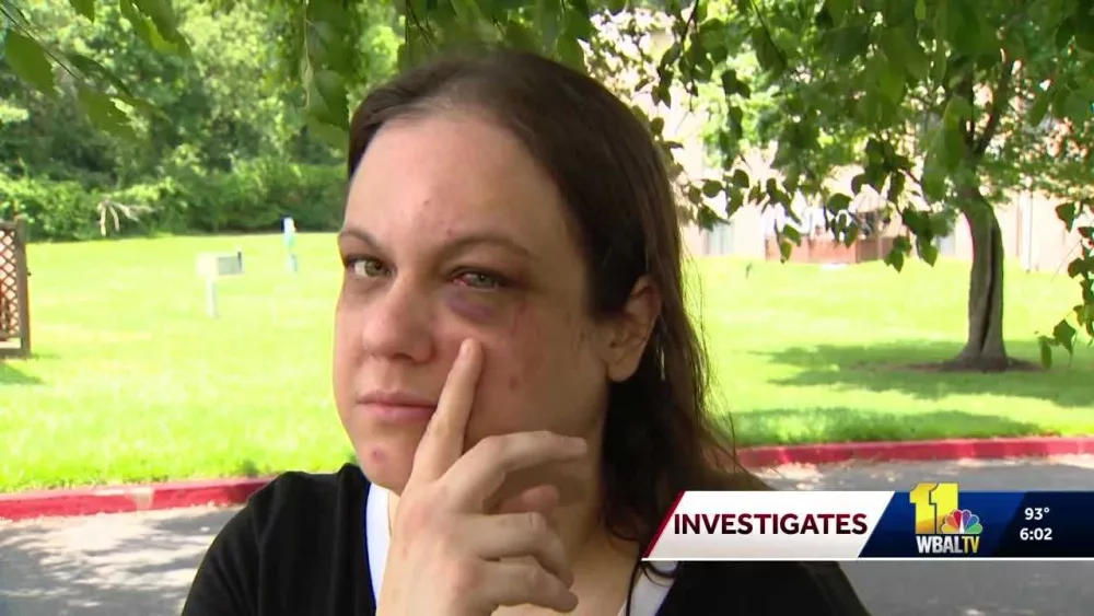 Nurse attacked after honking at car that stopped in middle of Maryland road