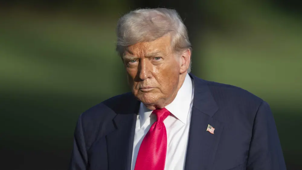 What is chronic venous insufficiency, the condition President Trump has been diagnosed with?