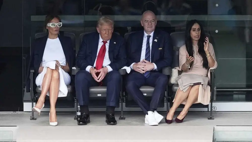What was President Trump diagnosed with? Get the facts on chronic venous insufficiency