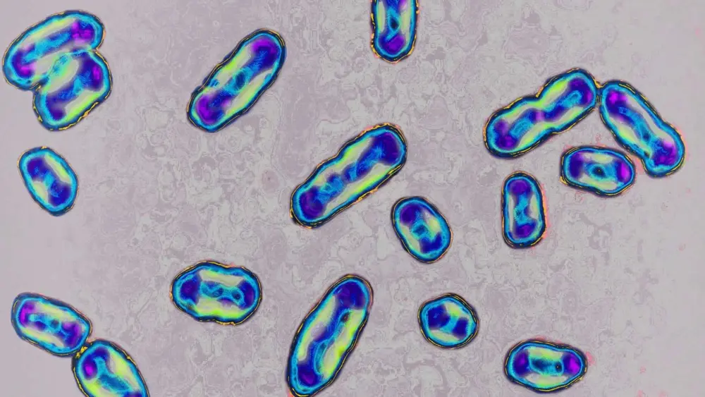 An Arizona resident has just died of the plague — Here's what to know about this disease