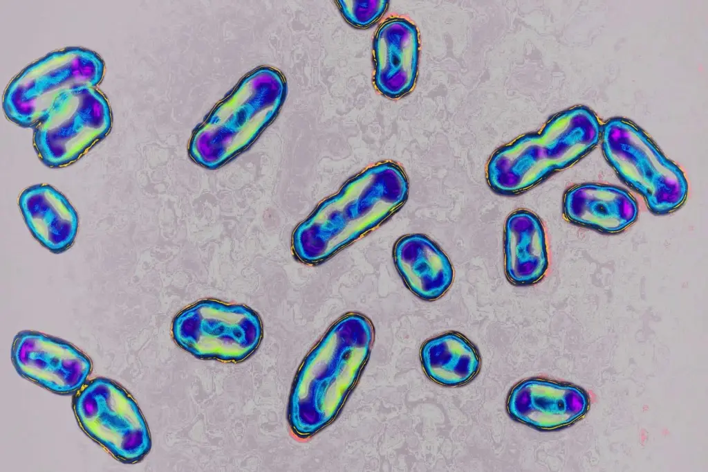 An Arizona resident has just died of the plague — Here's what to know about this disease