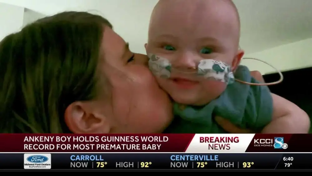 Most premature baby to survive becomes Guinness World Record holder