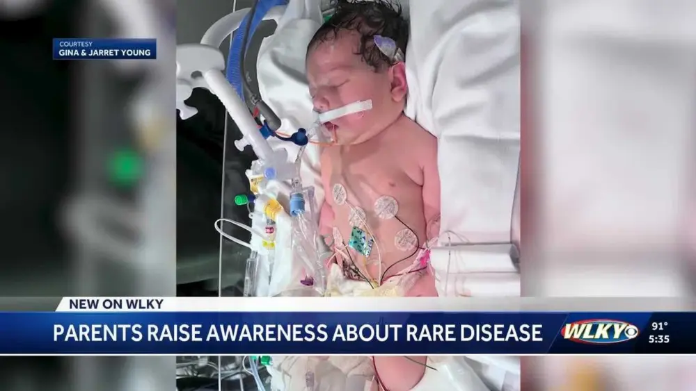 Parents share daughter's battle with rare genetic disorder to raise awareness