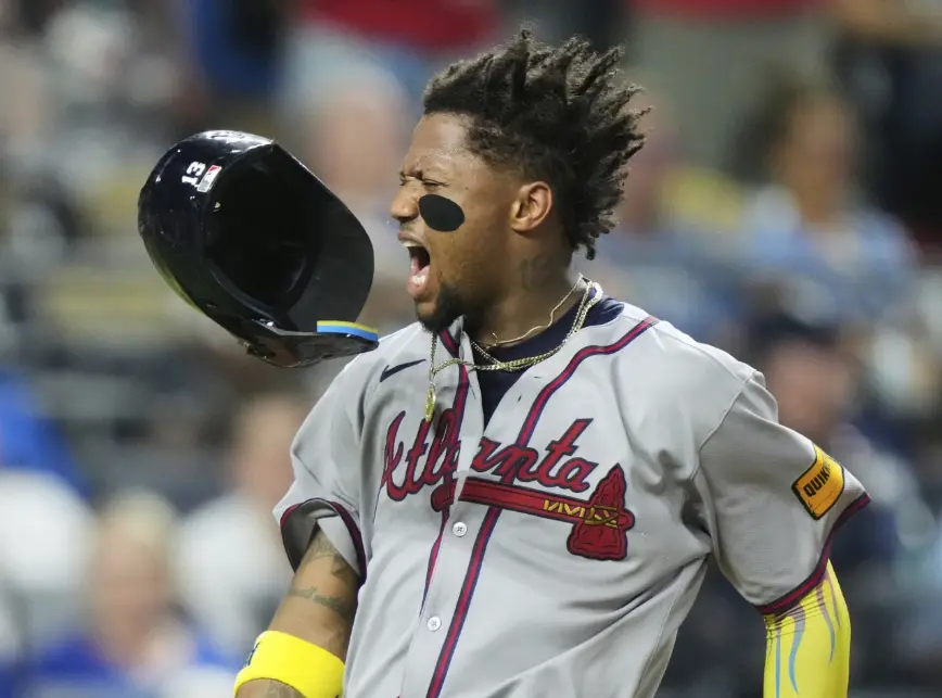 Braves place Ronald Acuña Jr. on injured list with Achilles tendon inflammation