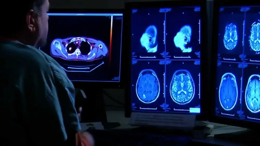 What to know about CTE, the brain disease the NYC shooter blamed for his mental health issues