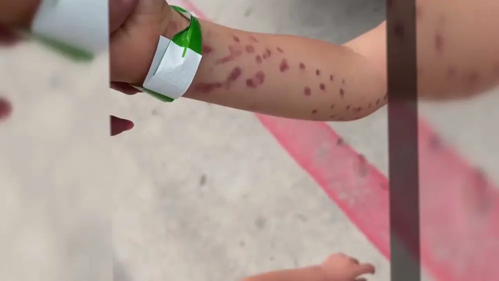 6-year-old boy left covered in bruises after octopus grabbed his arm at aquarium