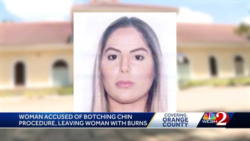 Florida woman accused of practicing medicine without a license after botched chin surgery