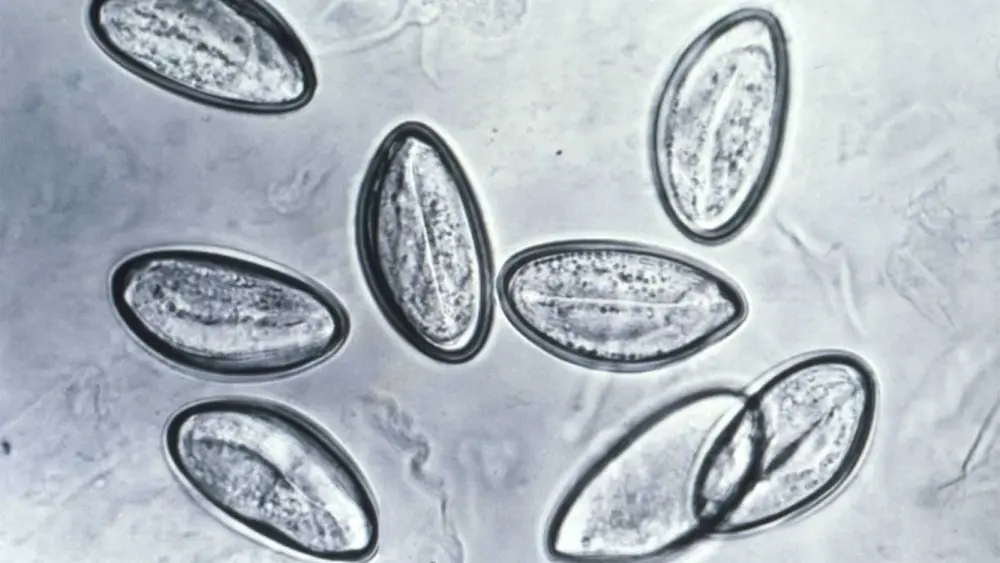 Do you need to cleanse your body of parasites? A doctor explains the social media fad
