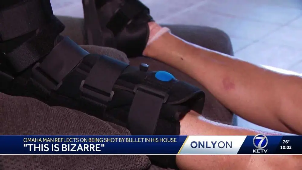 'This is bizarre': Man reflects on bullet coming through house and hitting him