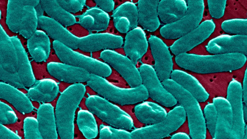 Flesh-eating bacteria cases are rising. Climate change is to blame, say scientists