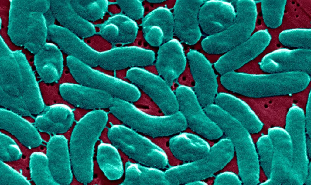 Flesh-eating bacteria cases are rising. Climate change is to blame, say scientists