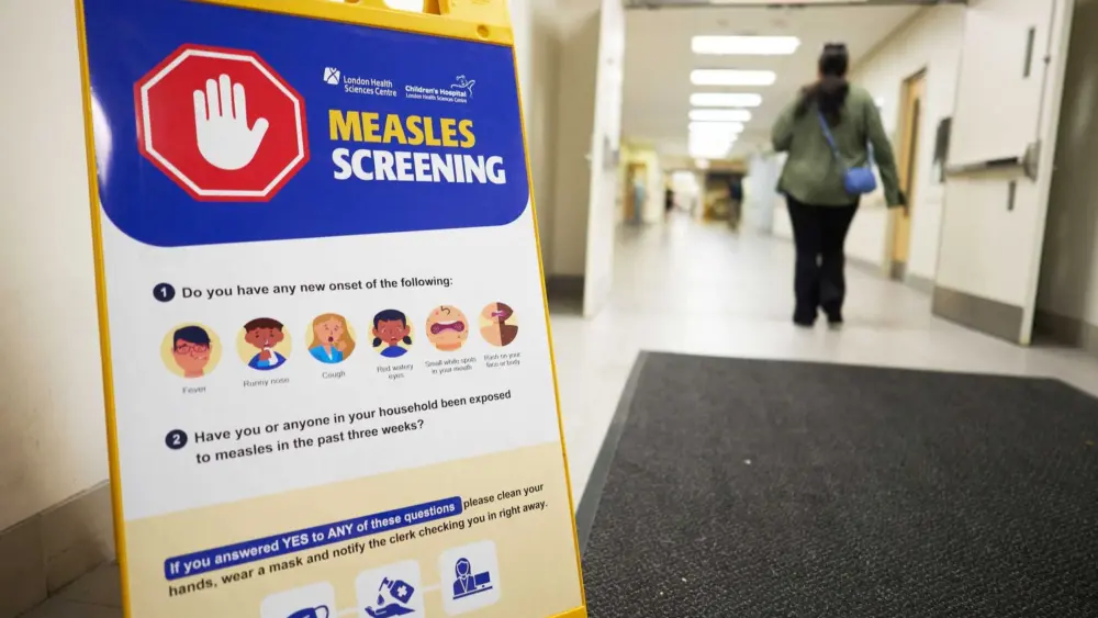 Canada is poised to lose its measles elimination status. The US could, too