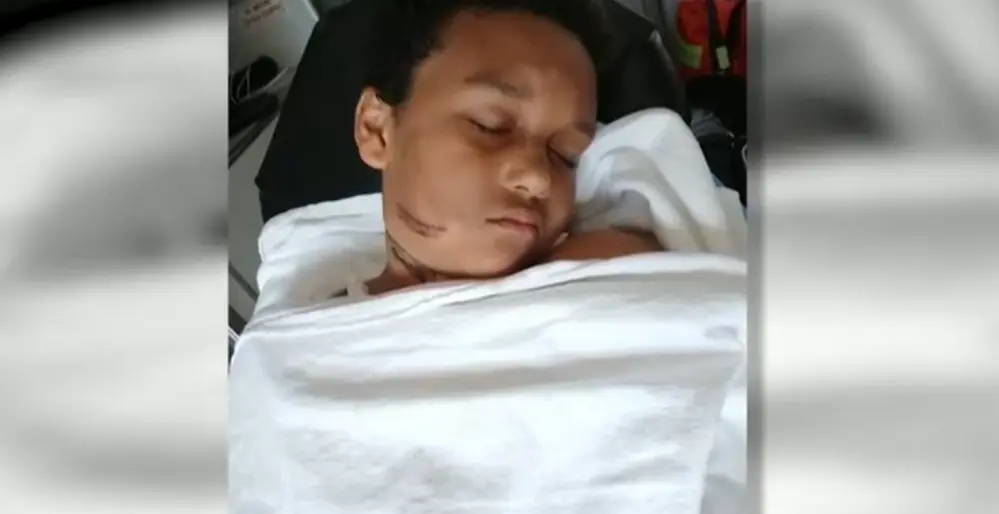 9-year-old boy lucky to be alive after suffering serious burns from tablet charger