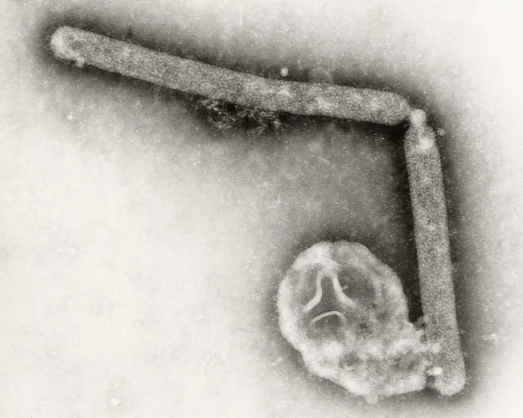 Strain of bird flu virus never before reported in people is behind first human case in US in nine months