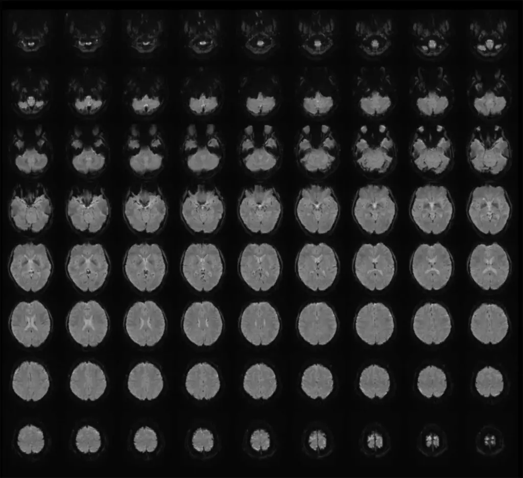 Scientist turns people's mental images into text using 'mind-captioning' technology